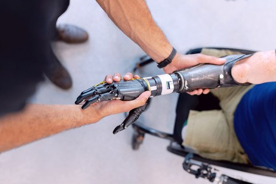 Con MAIA, l’intelligenza artificiale muove le protesi dei pazienti neurolesi